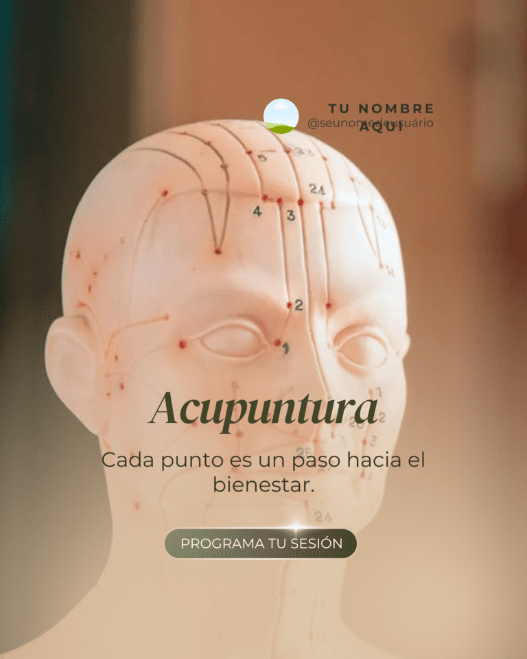 ACUPUNTURA-FEED-ES-5.png