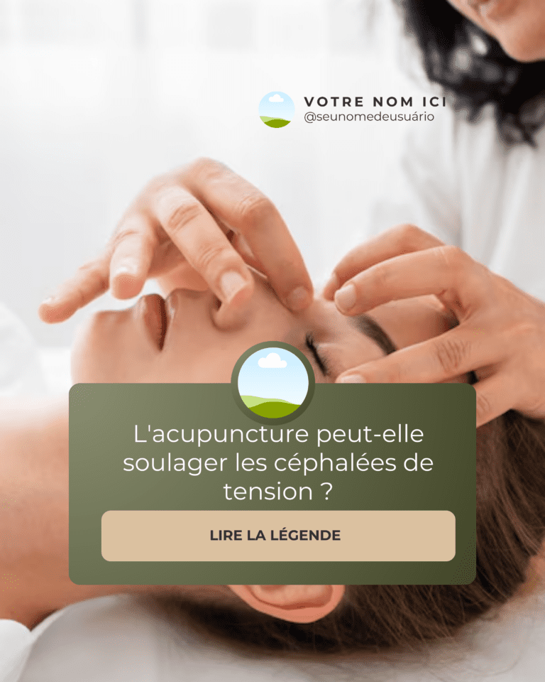 ACUPUNTURA FEED FR (1)