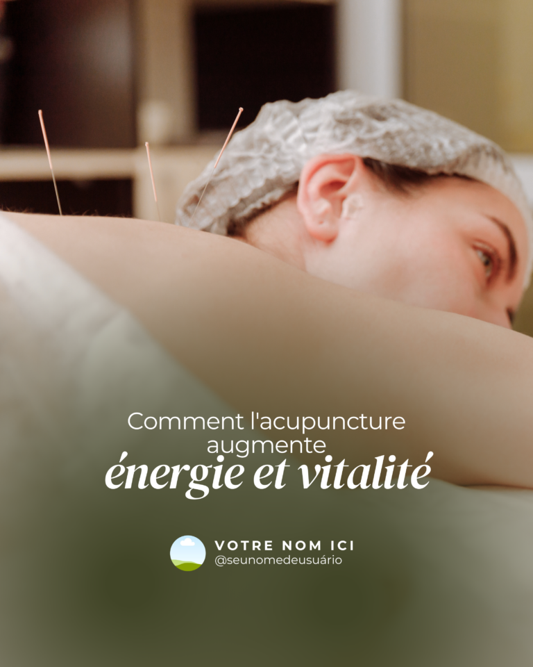 ACUPUNTURA FEED FR (3)