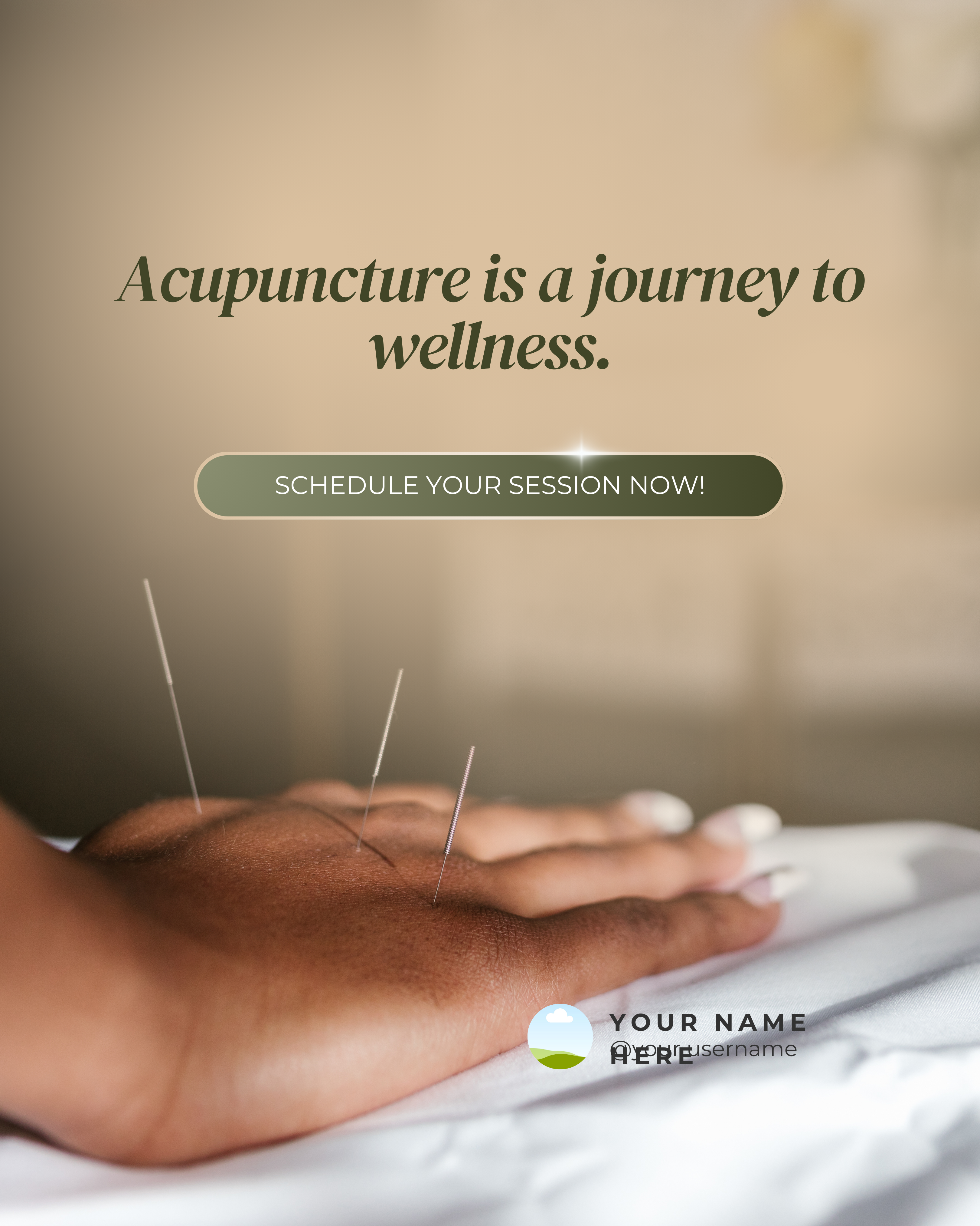 ACUPUNTURA FEED ING (3)